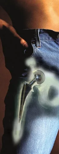 medical_hip-joint_male.jpg